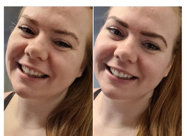 2x ProWhitening Strips