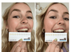 ProWhitening Strips