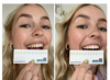 2x ProWhitening Strips