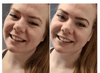 ProWhitening Strips