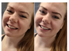 2x ProWhitening Strips
