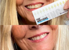 ProWhitening Strips
